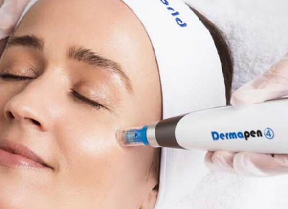 dermapen 4.0